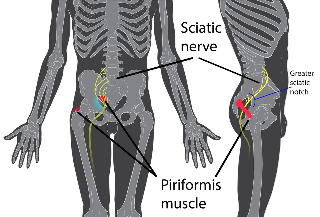Muscle piriforme : anatomie, rôle et pourquoi il cause tant de problèmes