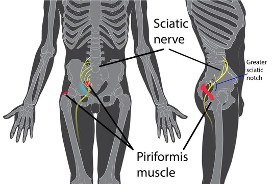 Muscle piriforme : anatomie, rôle et pourquoi il cause tant de problèmes